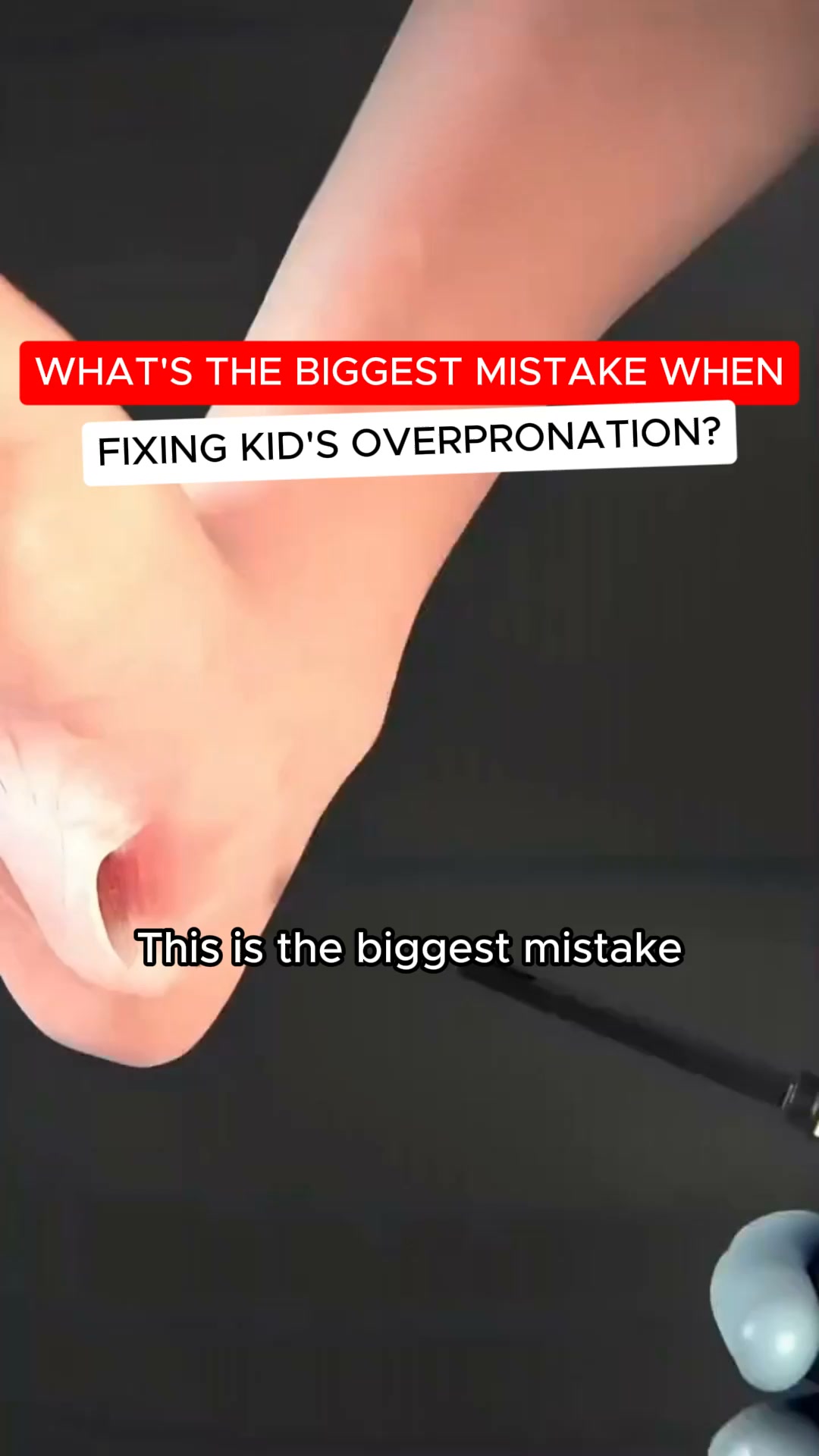 Dr. Blane - Pediatric Specialist Facebook ad: Support Flat Feet the Right Way