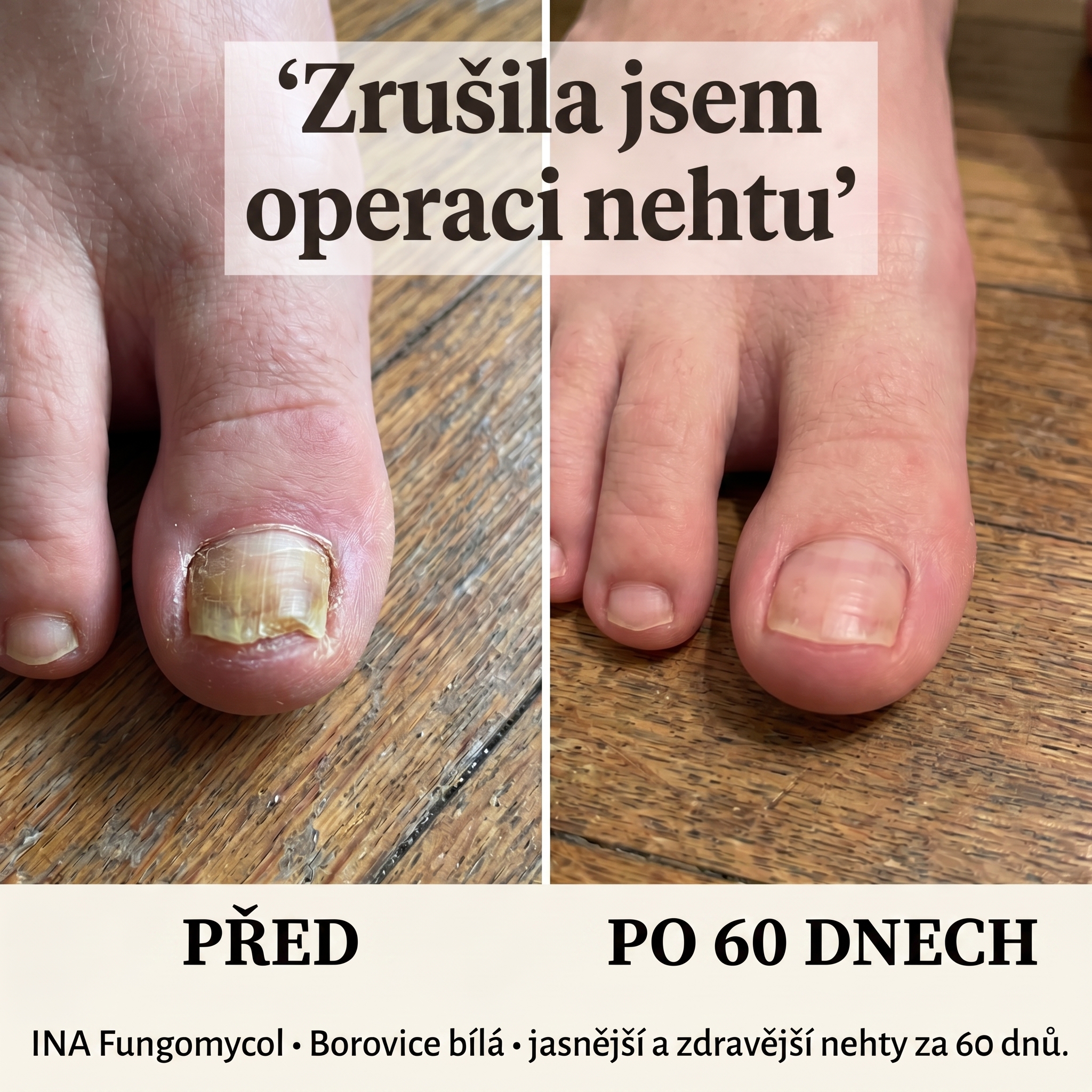 Organická Kosmetika - InaEssentials.cz Facebook ad: Zrusila operaci nehtu. Tady je duvod.