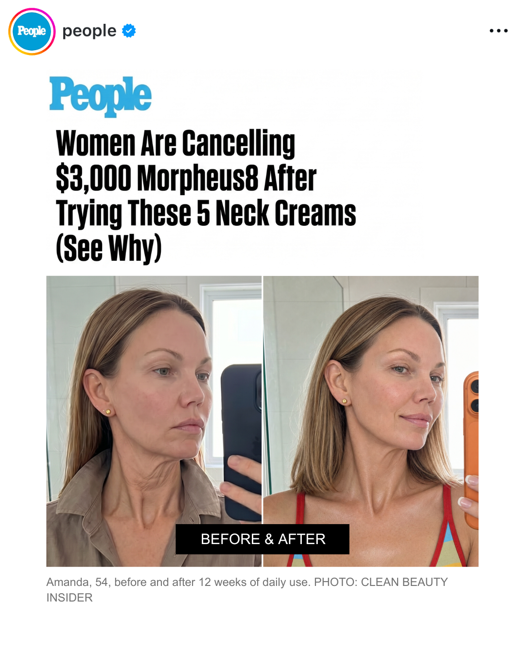 Clean Beauty Insider Facebook ad: 5 Best Neck Creams According to Derms