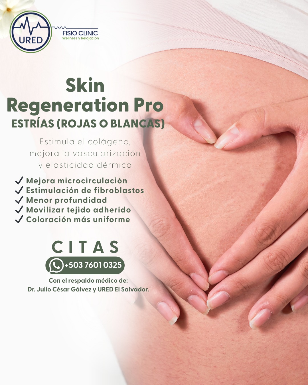 URED Fisio Clinic - El Salvador Facebook ad: Las estrías cuentan historias… pero no tienen que…