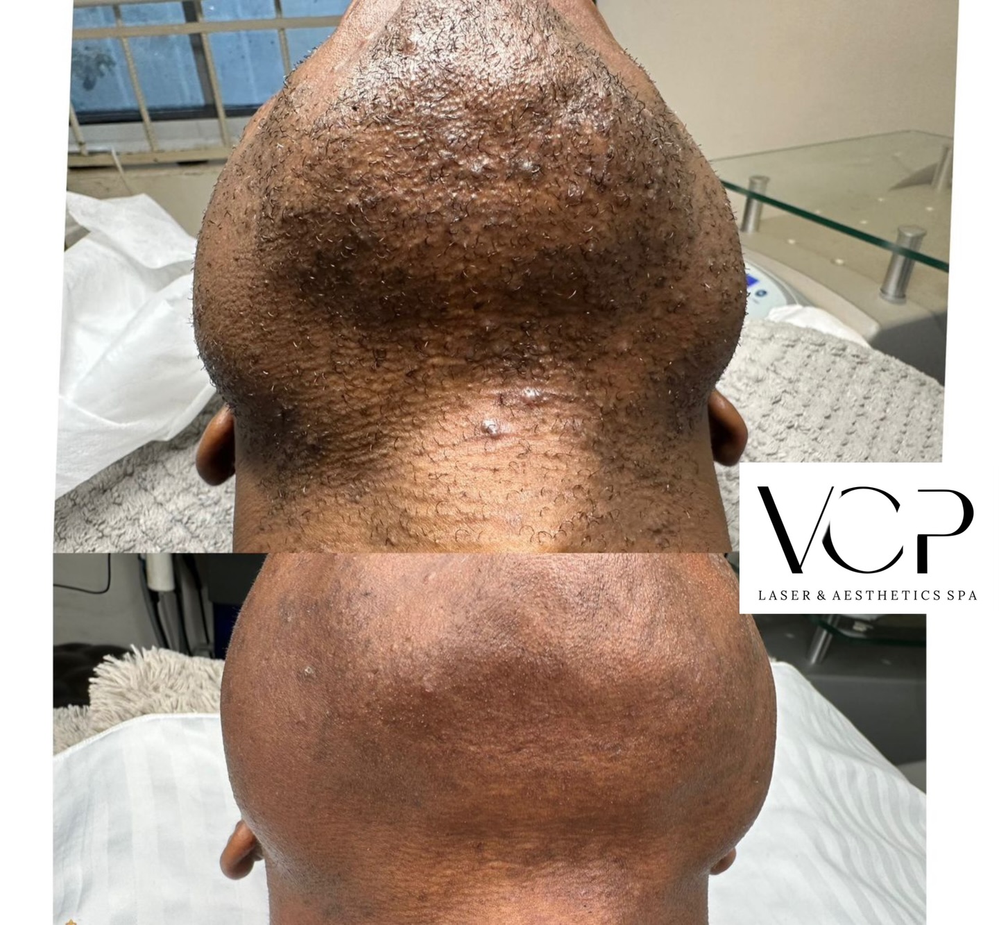 VCP Laser & Aesthetics Facebook ad: Real results, real confidence