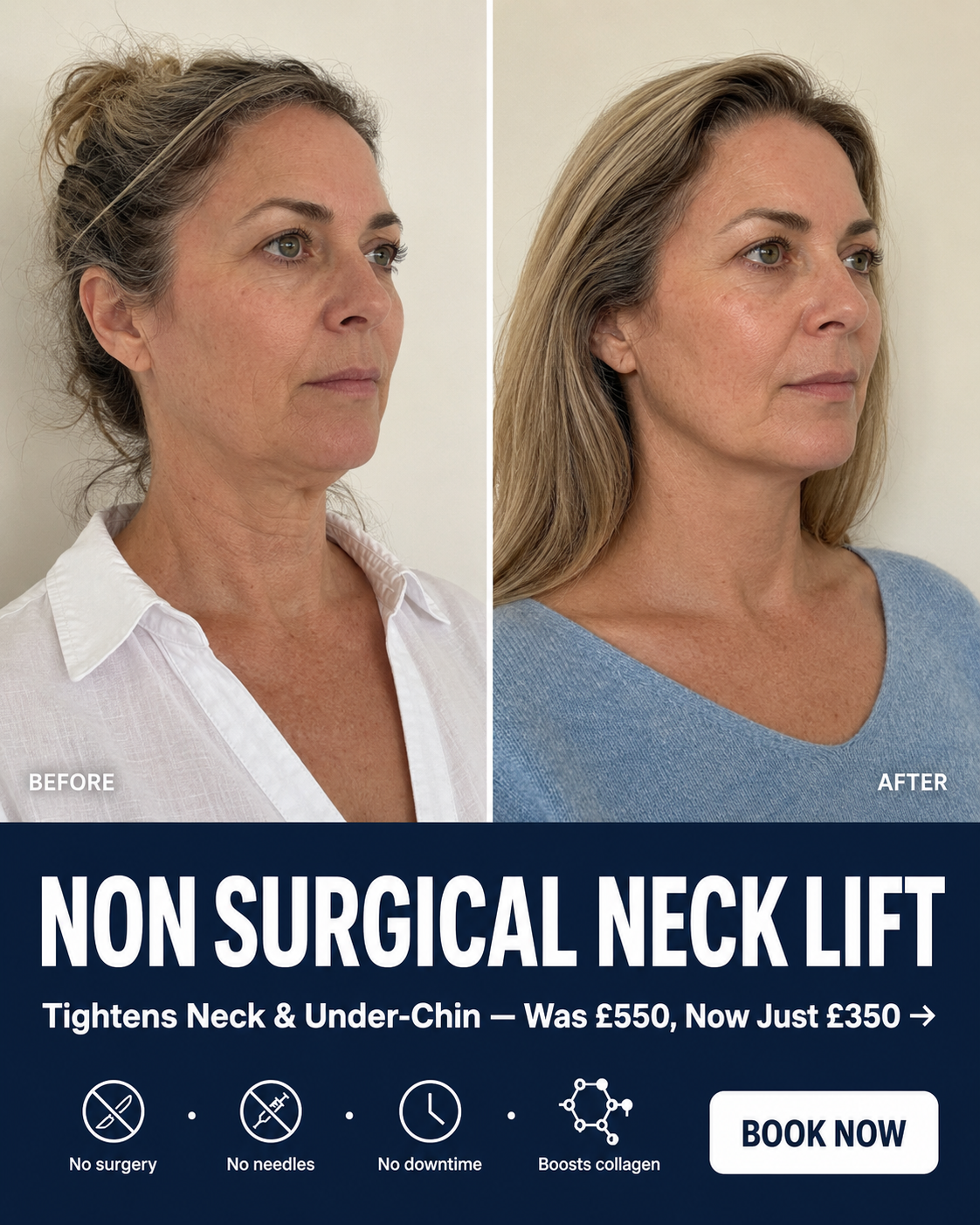 rsakskinandaesthetics Facebook ad: Non Surgical Neck Lift, Now £350 (Was £550)