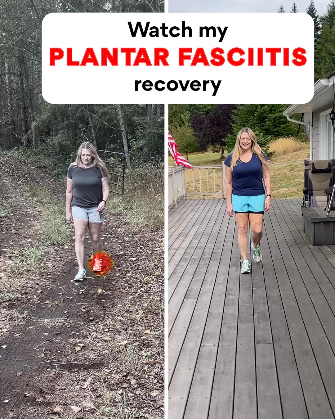 The Xstance Facebook ad: Stand All Day Effortlessly