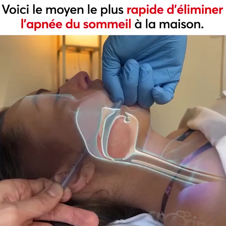 Dr Noviq Facebook ad: Résultats garantis ou remboursement en 4 semaines