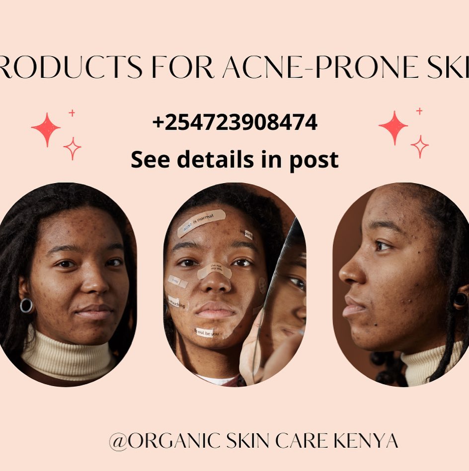 Organic skin care Kenya Facebook ad: WE ARE THE ACNE EXPERTS!