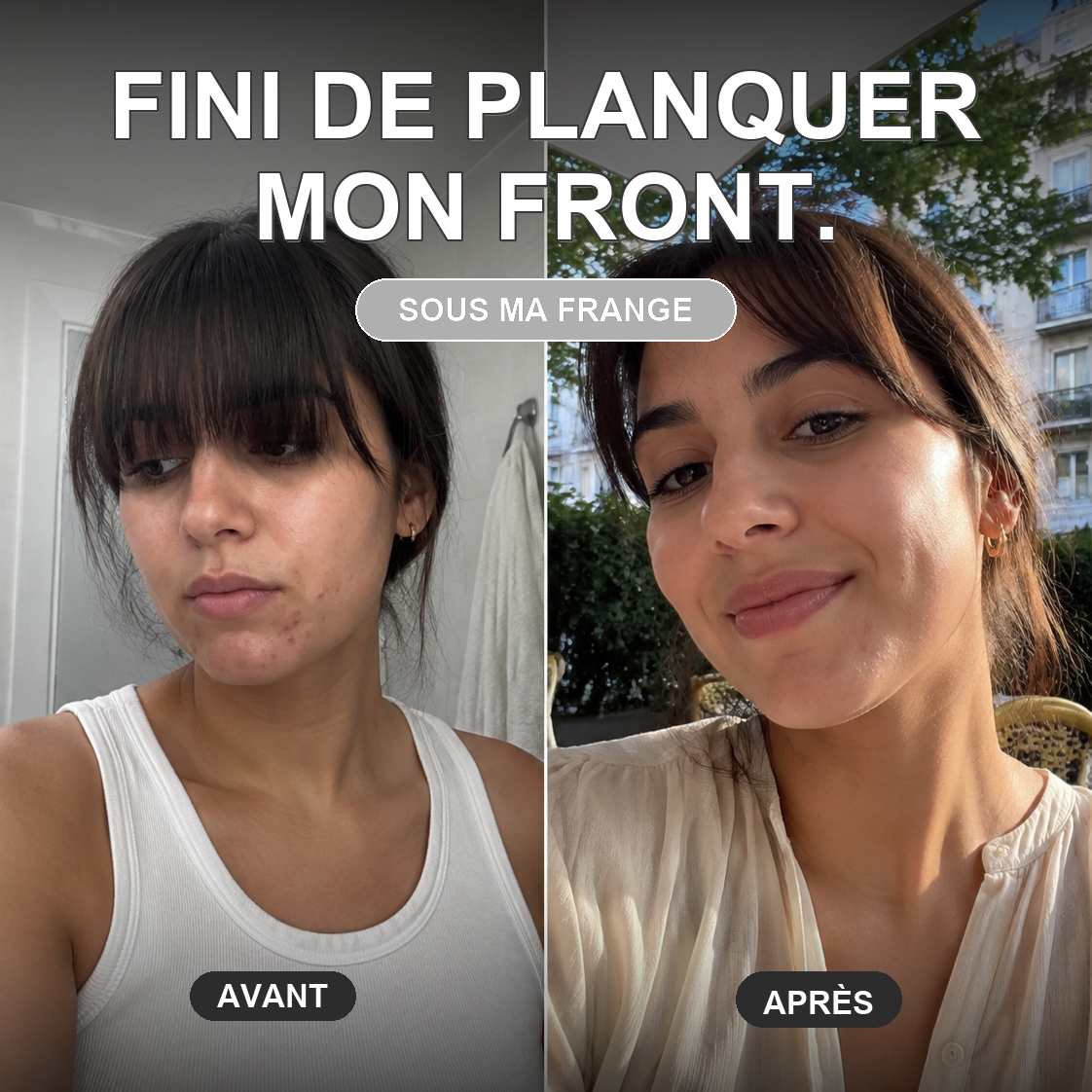 Mona Ritual Facebook ad: L'acné hormonale a sa cure.