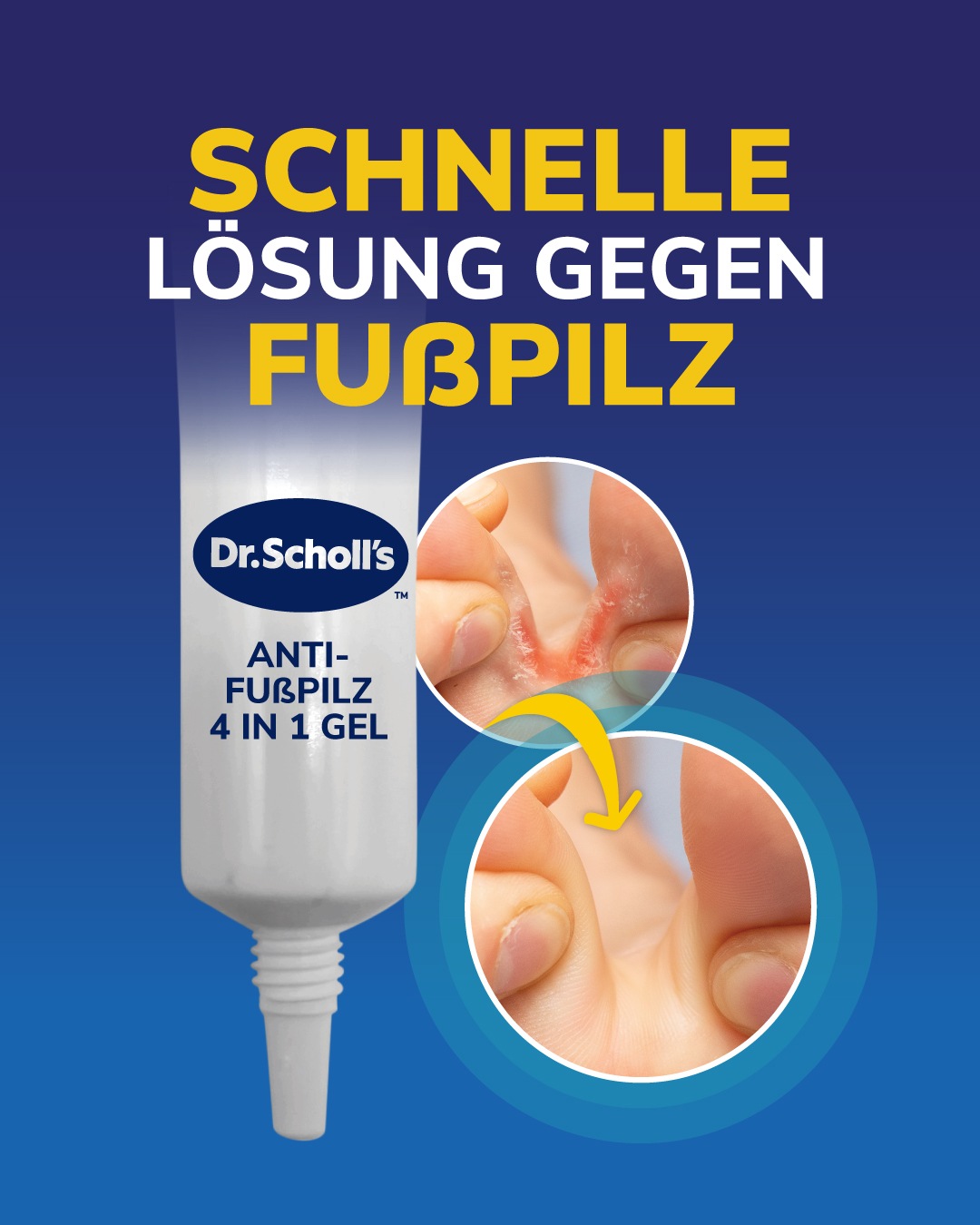Scholl Fußpflege Deutschland Facebook ad: Bekämpfe die Ursache, nicht nur die Symptome