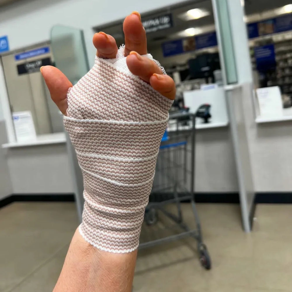 The Menopause Journal Facebook ad: Menopause did this to her hands