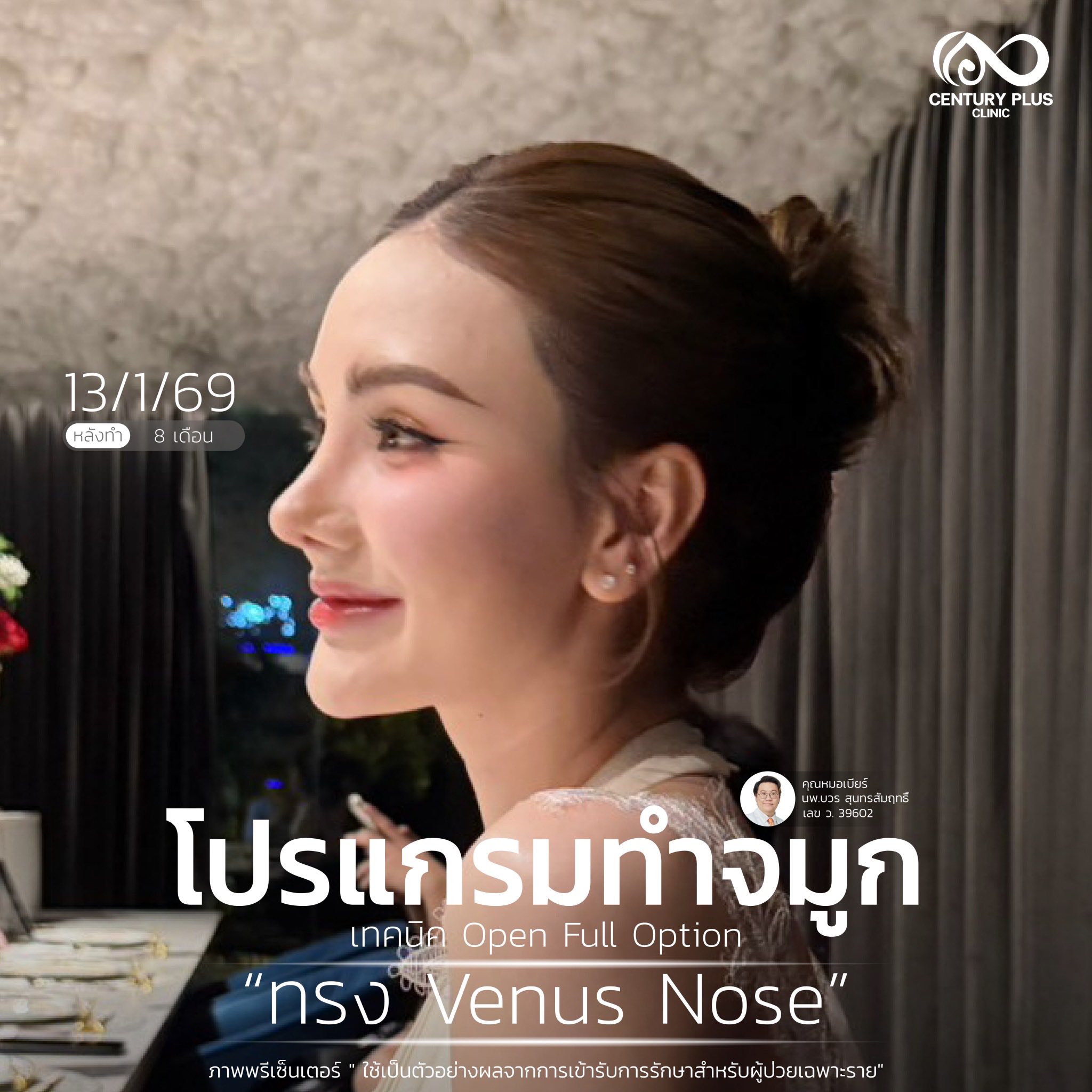 Century Health Clinic Facebook ad: สวยสง่าอย่างมีระดับ. กับทรงจมูกที่ปรับมาเพื่อคุณ