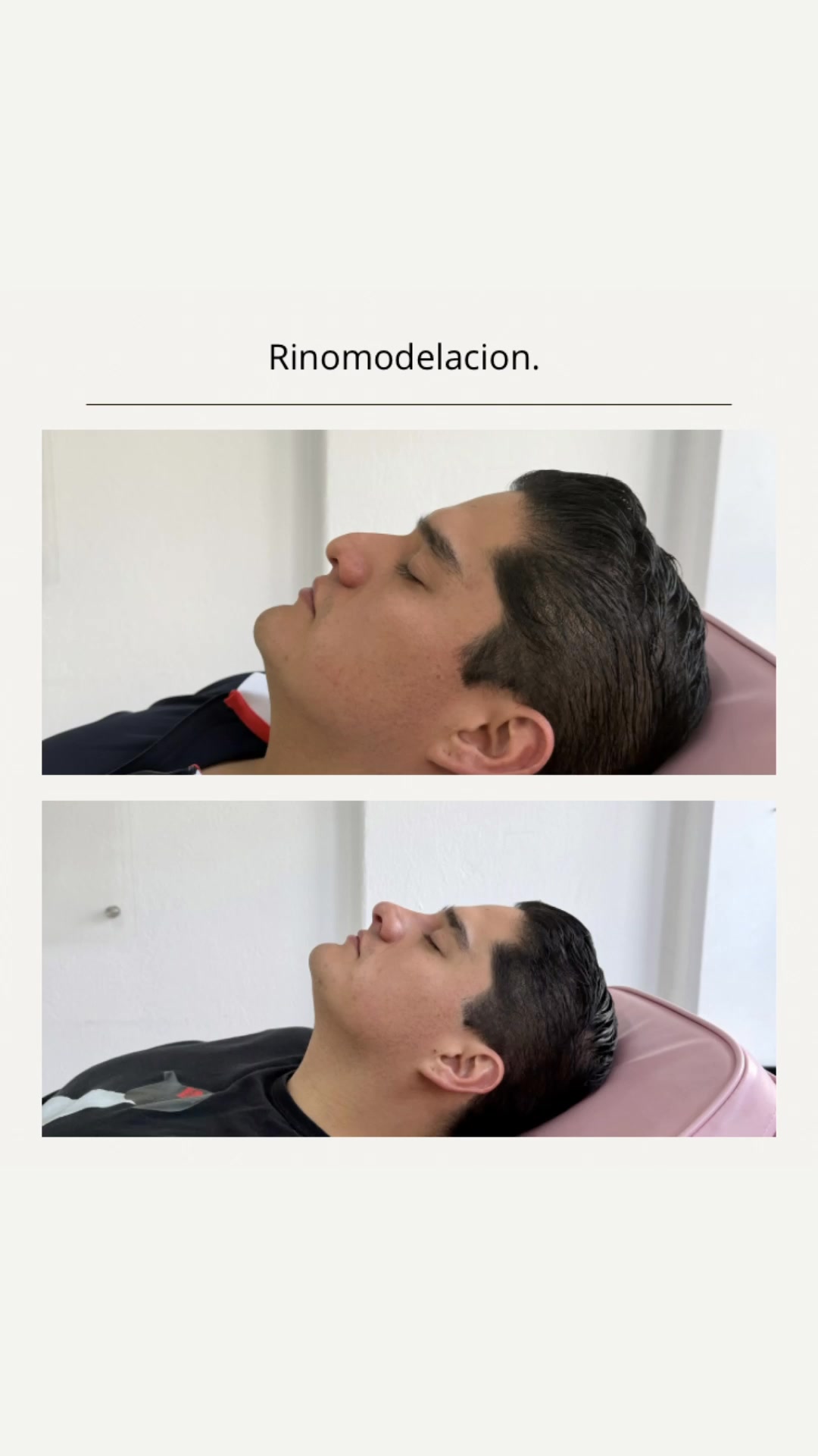 Clínica RGC - Medicina Estética. Facebook ad: ¡Agenda tu cita ahora!