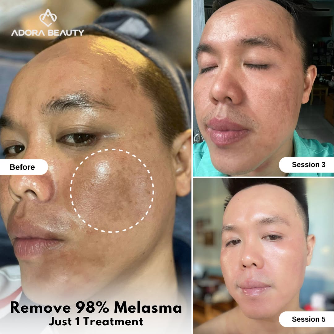 Adora International Aesthetic Institute - Elevating Beauty Facebook ad: Free consultation now