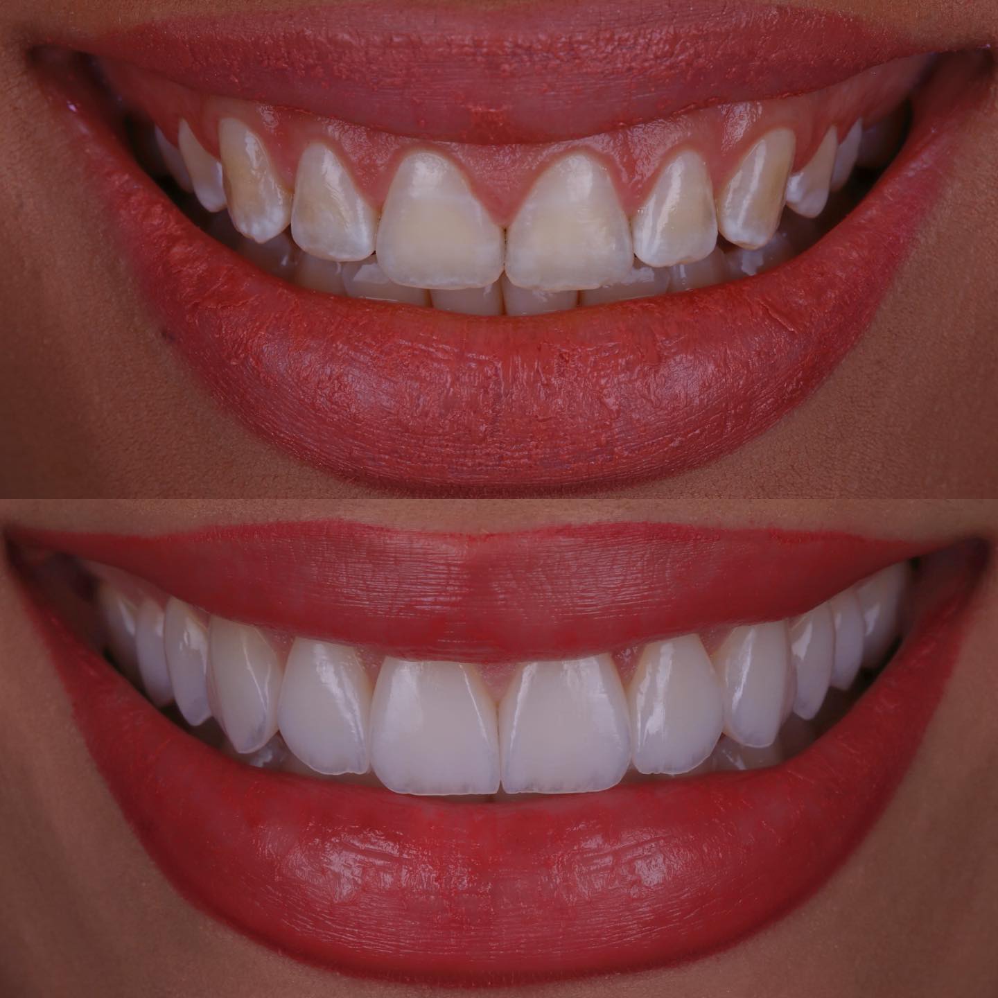 Rildo Lasmar Odontologia e Estética Facebook ad