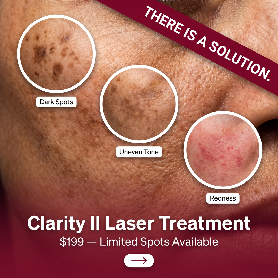 Renew Med Spa Facebook ad: 50% OFF This Month!