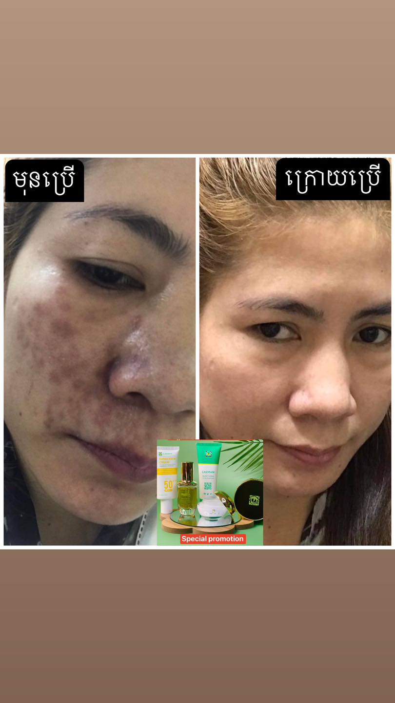 ប្រេងក្រពើខៃមែន Facebook ad