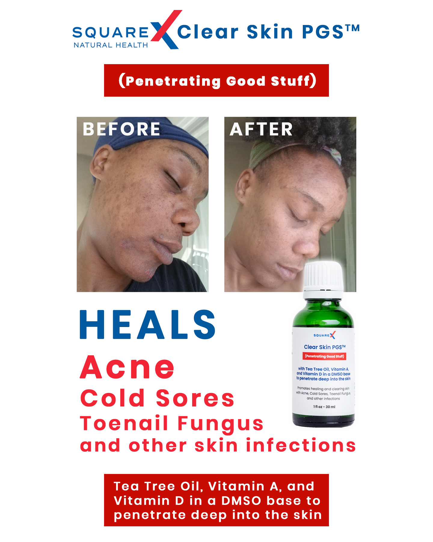 SquareX Natural Facebook ad from Jun 13, 2026