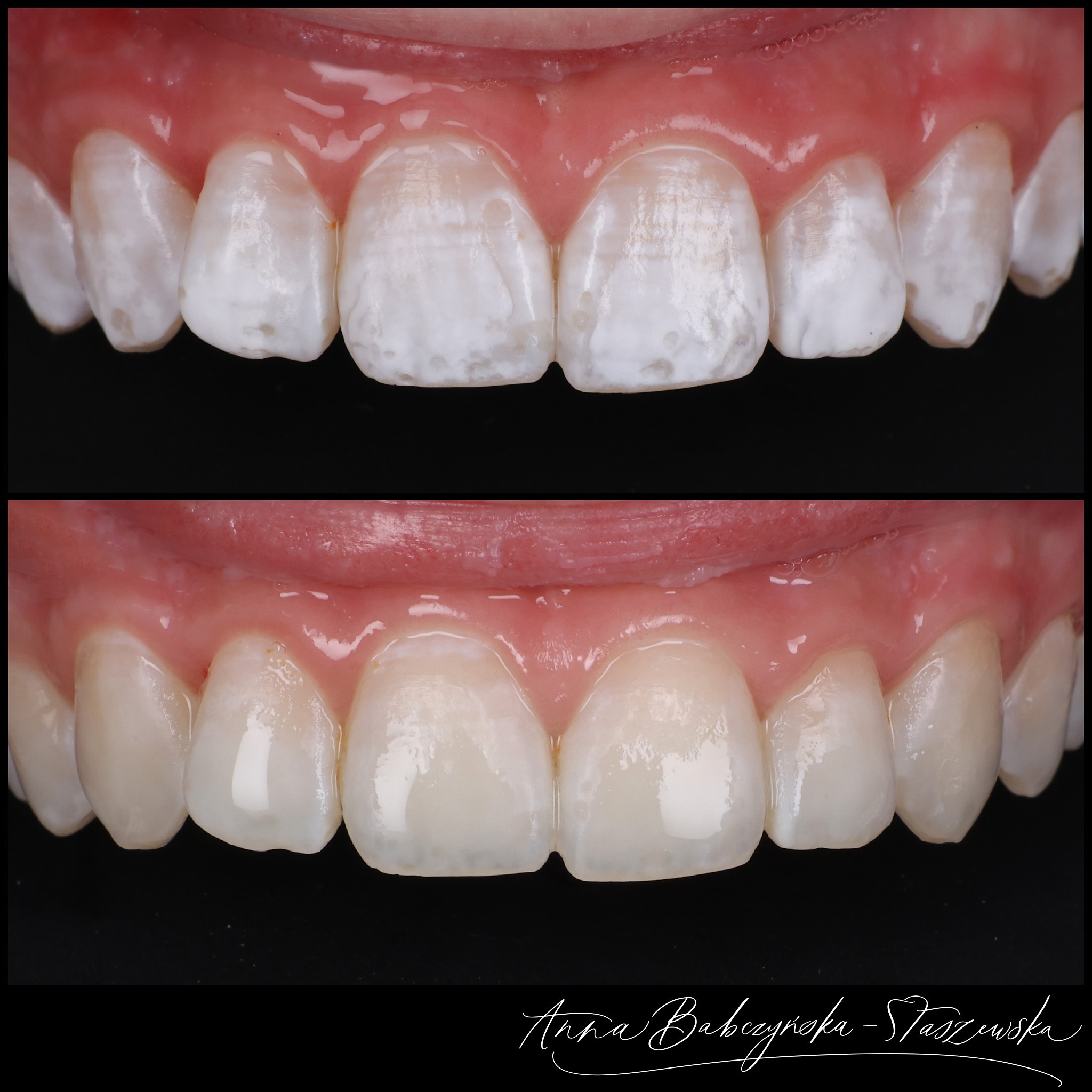 Anna.the.dentist Facebook ad: Przedstawiam Wam efekt minimalnie inwazyjnego leczenia…