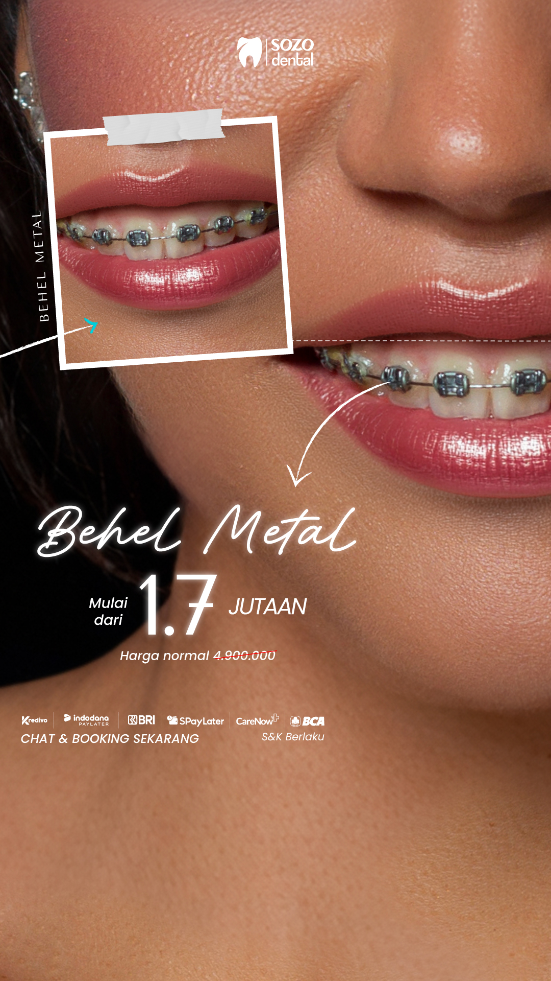 Sozo Dental Clinic Facebook ad