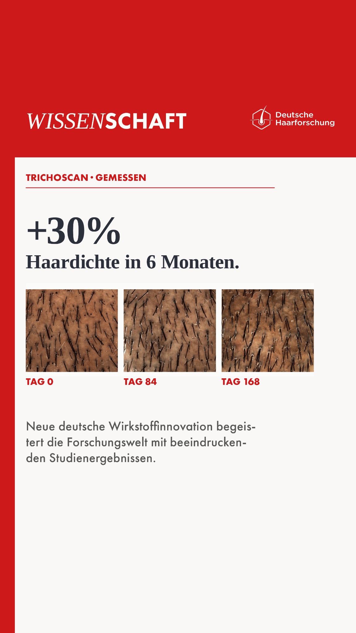 Deutsche Haarforschung Facebook ad from Jul 14, 2026