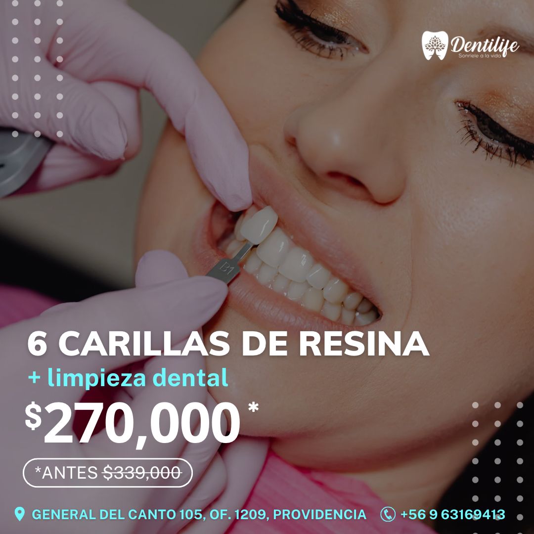 Dentilife Facebook ad
