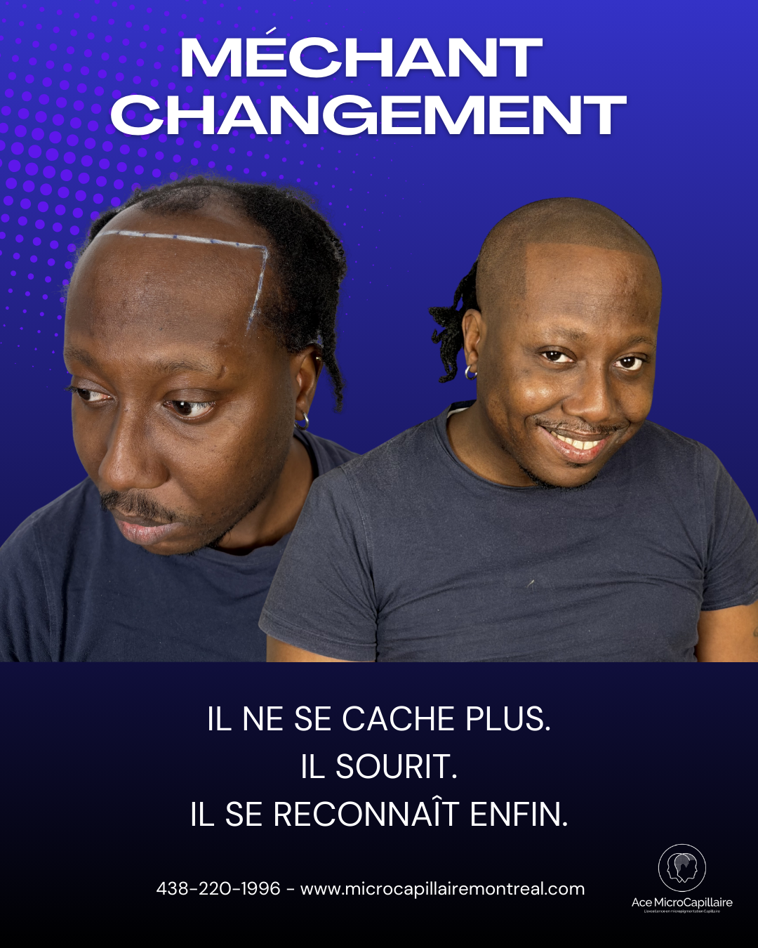 Clinique MicroCapillaire Montreal Facebook ad: Il ne se reconnaissait plus dans le miroir.