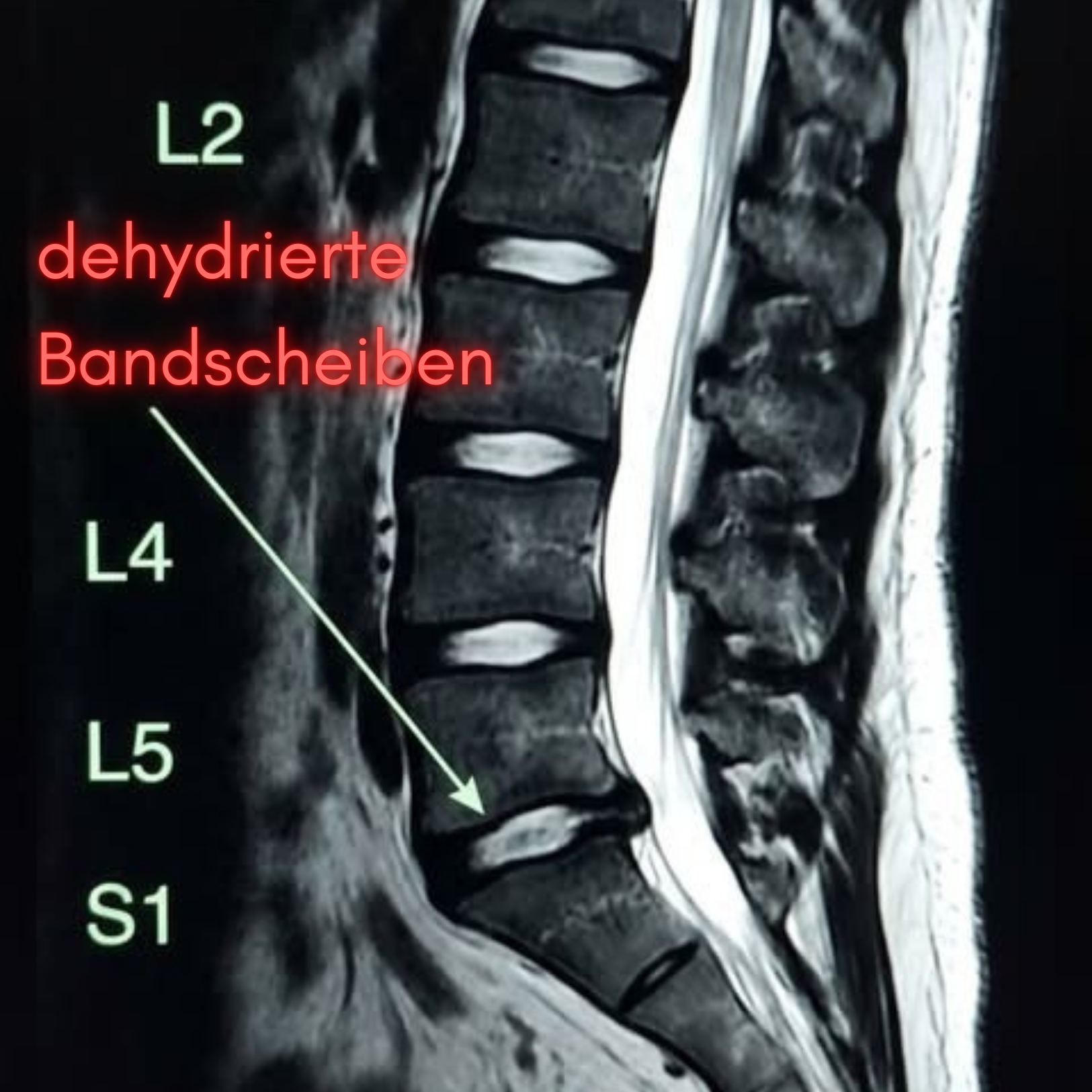 Sabine Müller Facebook ad: Was dir Chiropraktiker NICHT erzählen!