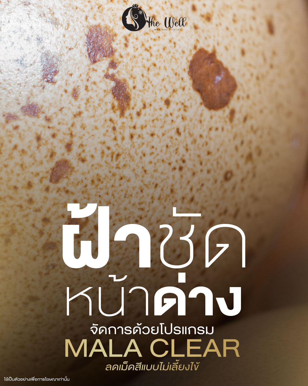 คลินิก เดอะเวล เจเจมอลล์ จตุจักร Facebook ad
