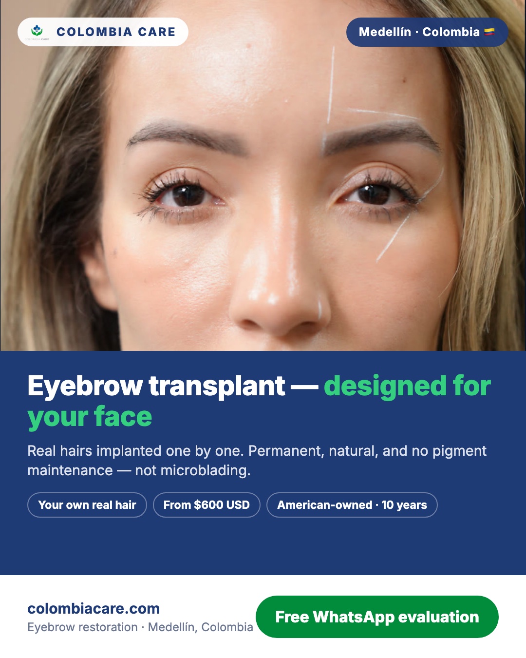 Colombia Care Hair Transplant Facebook ad