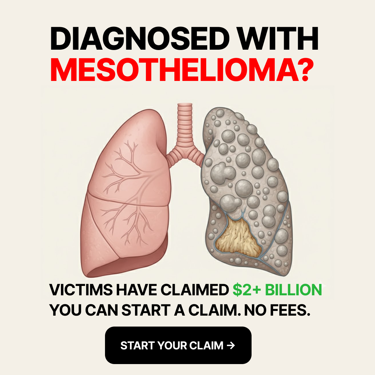 National Claims Facebook ad