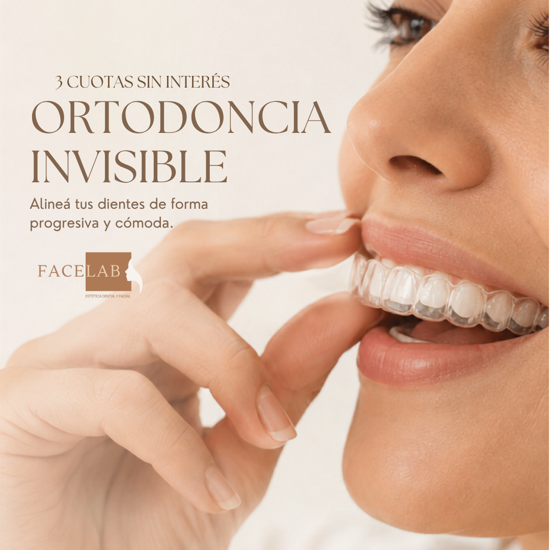 Facelab Facebook ad: Tu sonrisa puede cambiar… sin que nadie note…