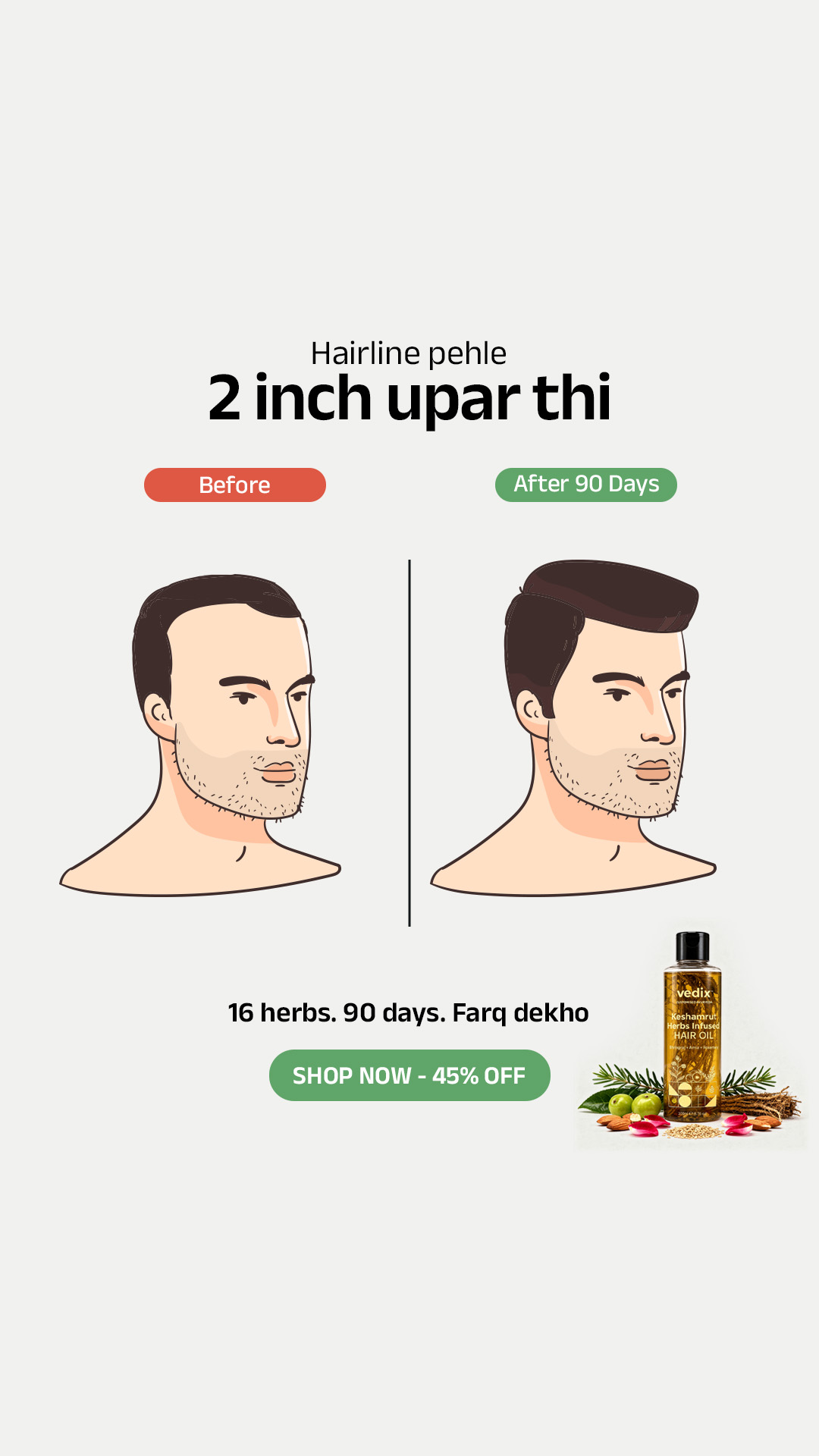 Vedix Facebook ad