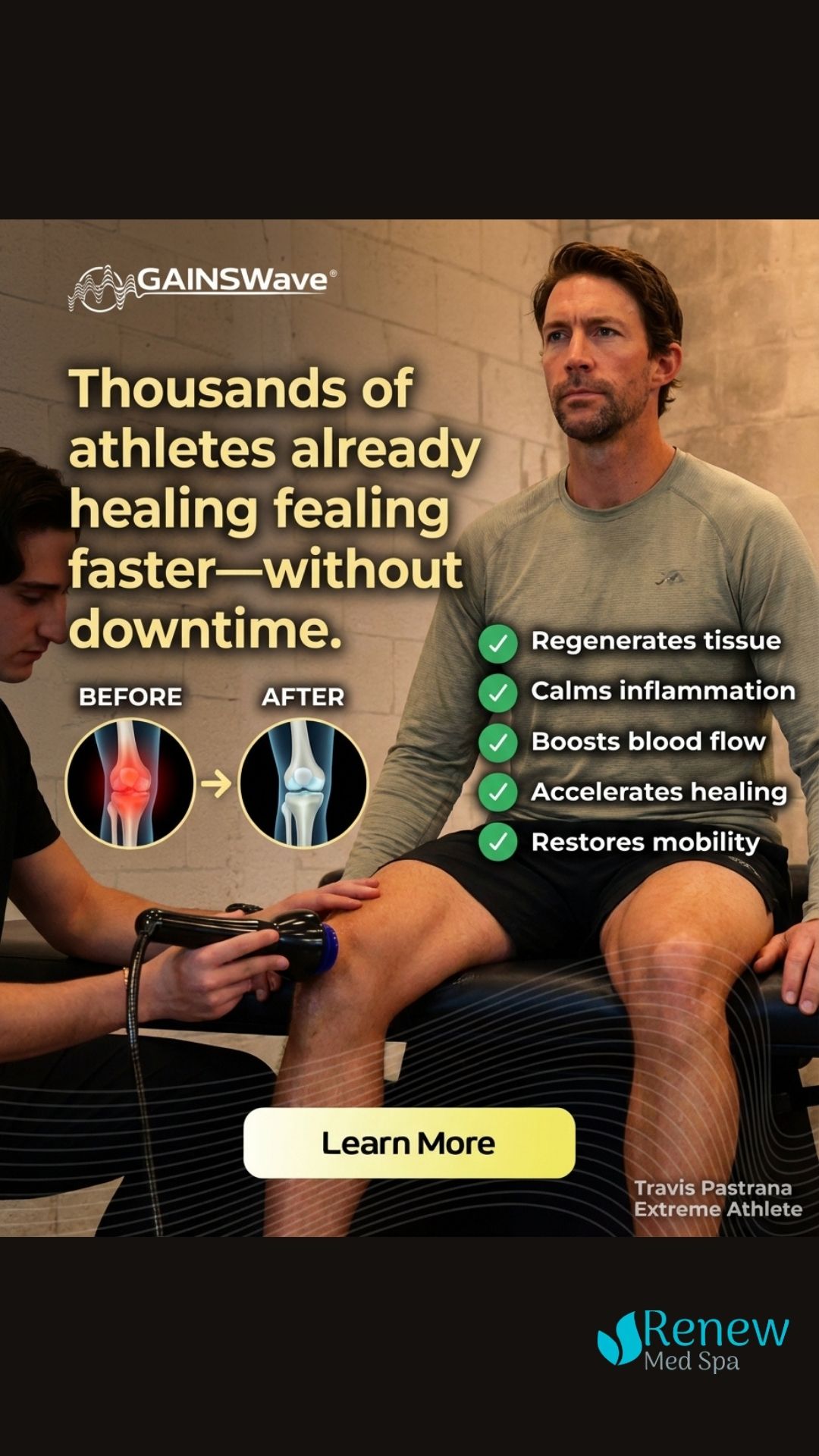 Renew Med Spa Facebook ad: 50% OFF This Month!