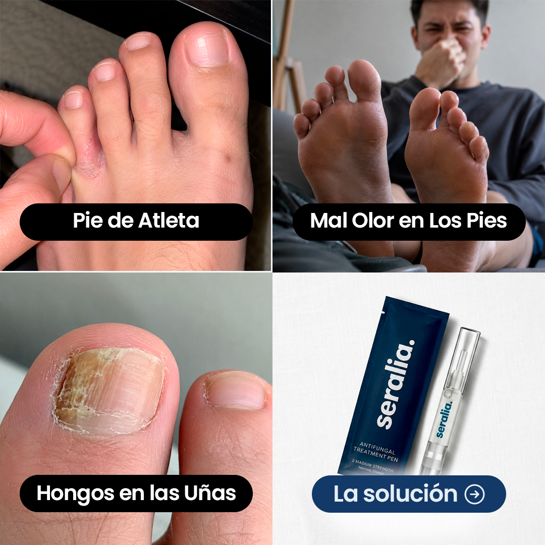 Seralia Facebook ad: Elimina hongos rápidamente