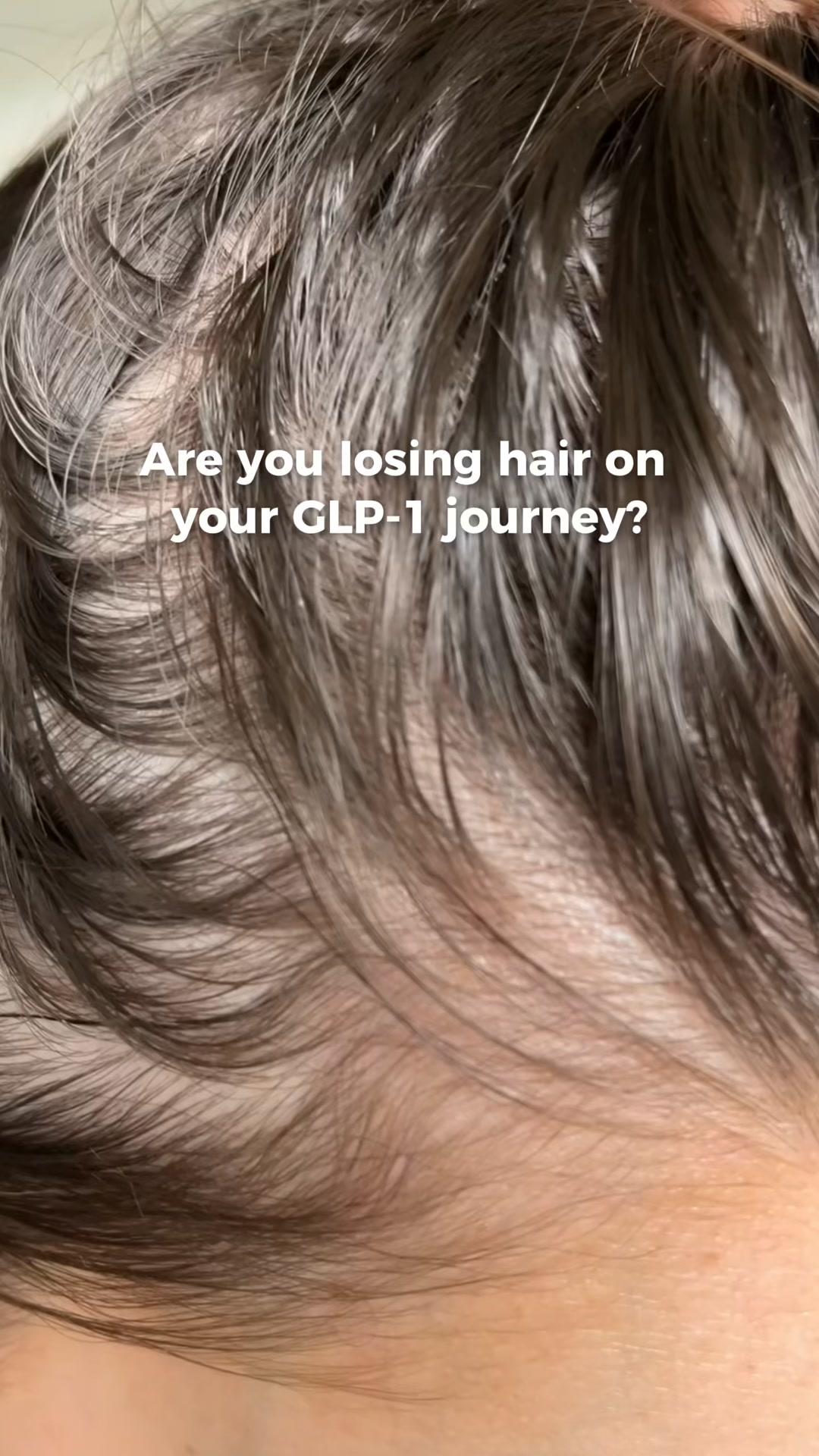HINU Facebook ad: Hair feeling thinner lately?