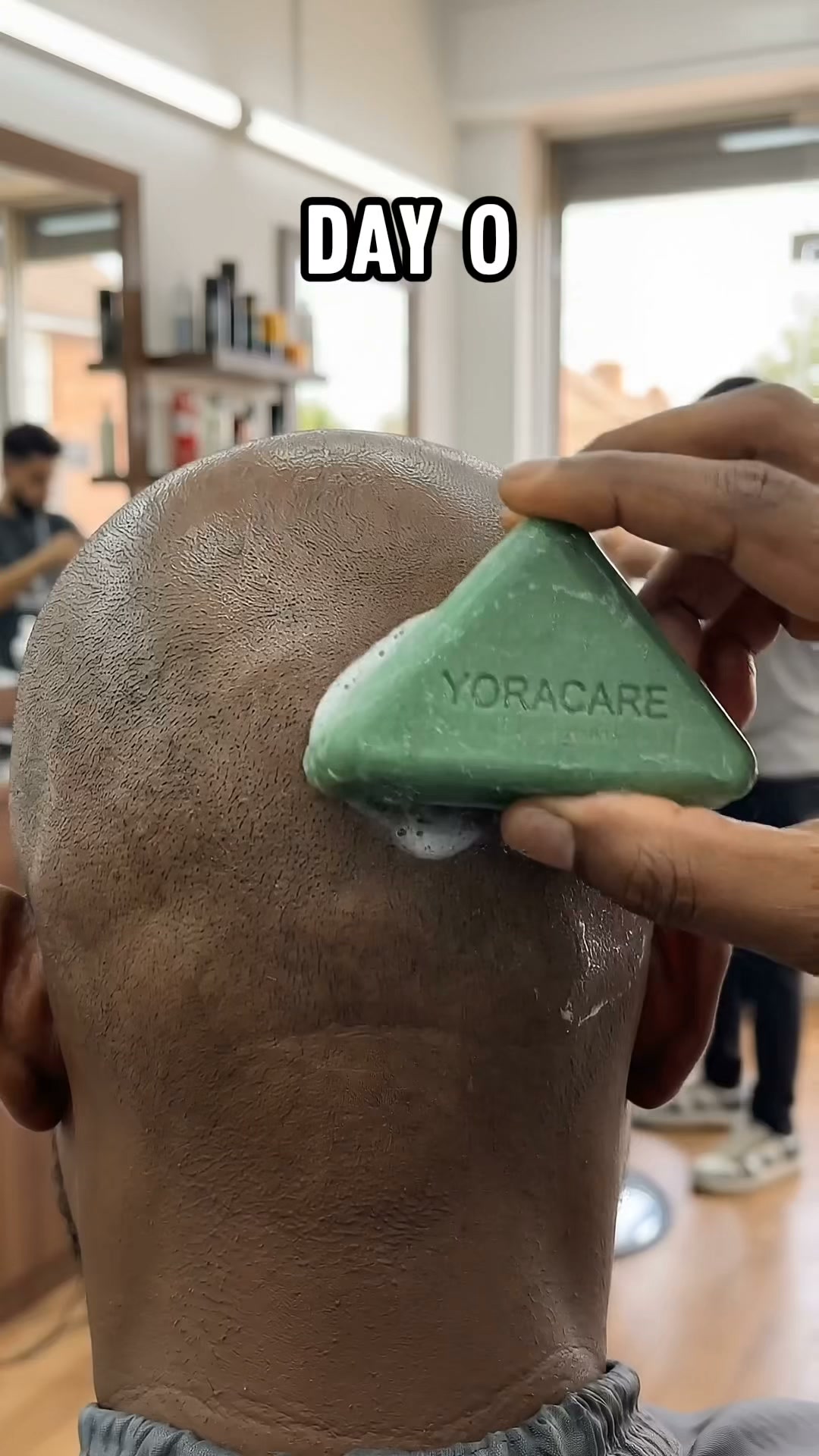 The Men's Hair Code Facebook ad: Korean Men Don't Go Bald Like We Do.