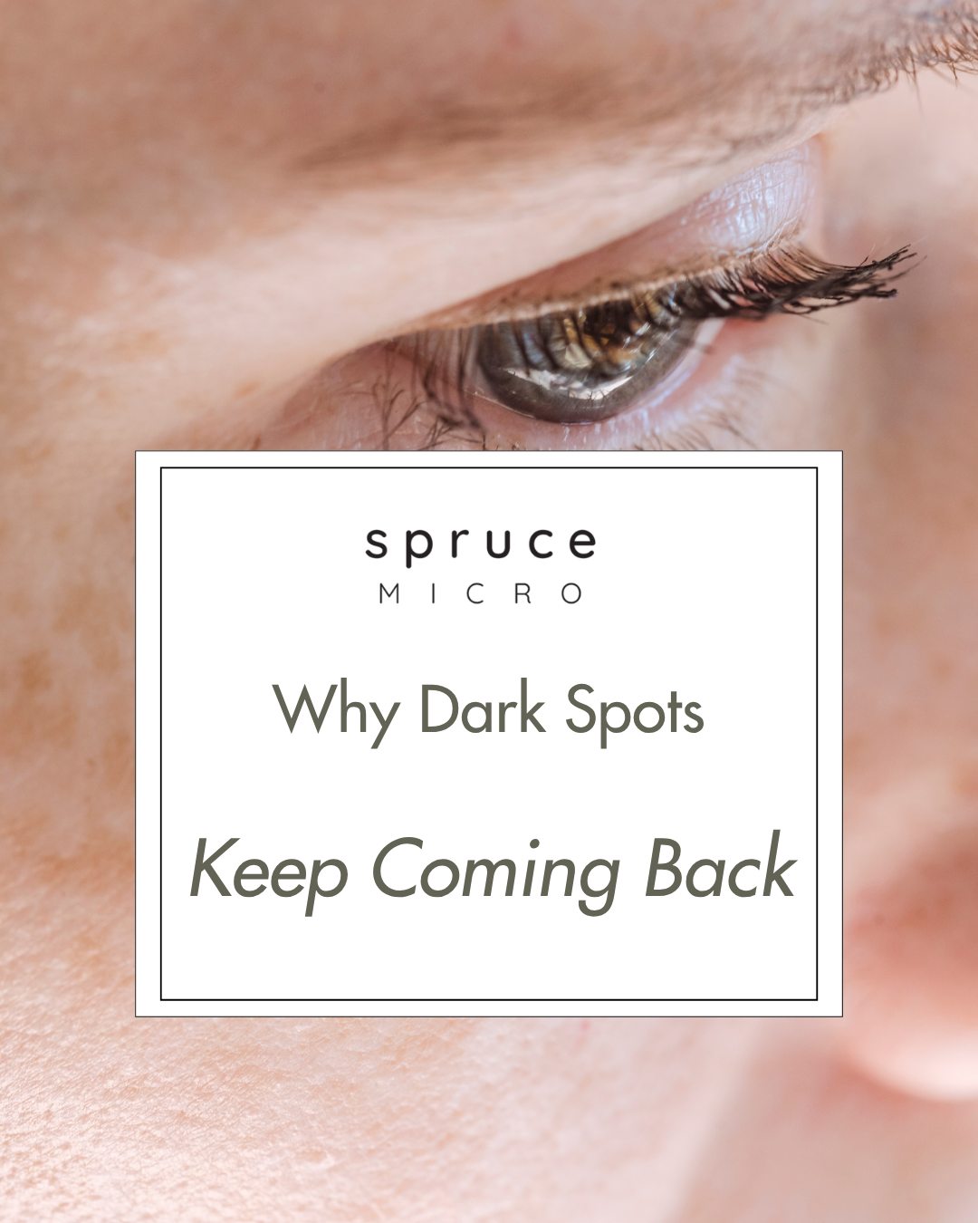 Spruce Micro Facebook ad