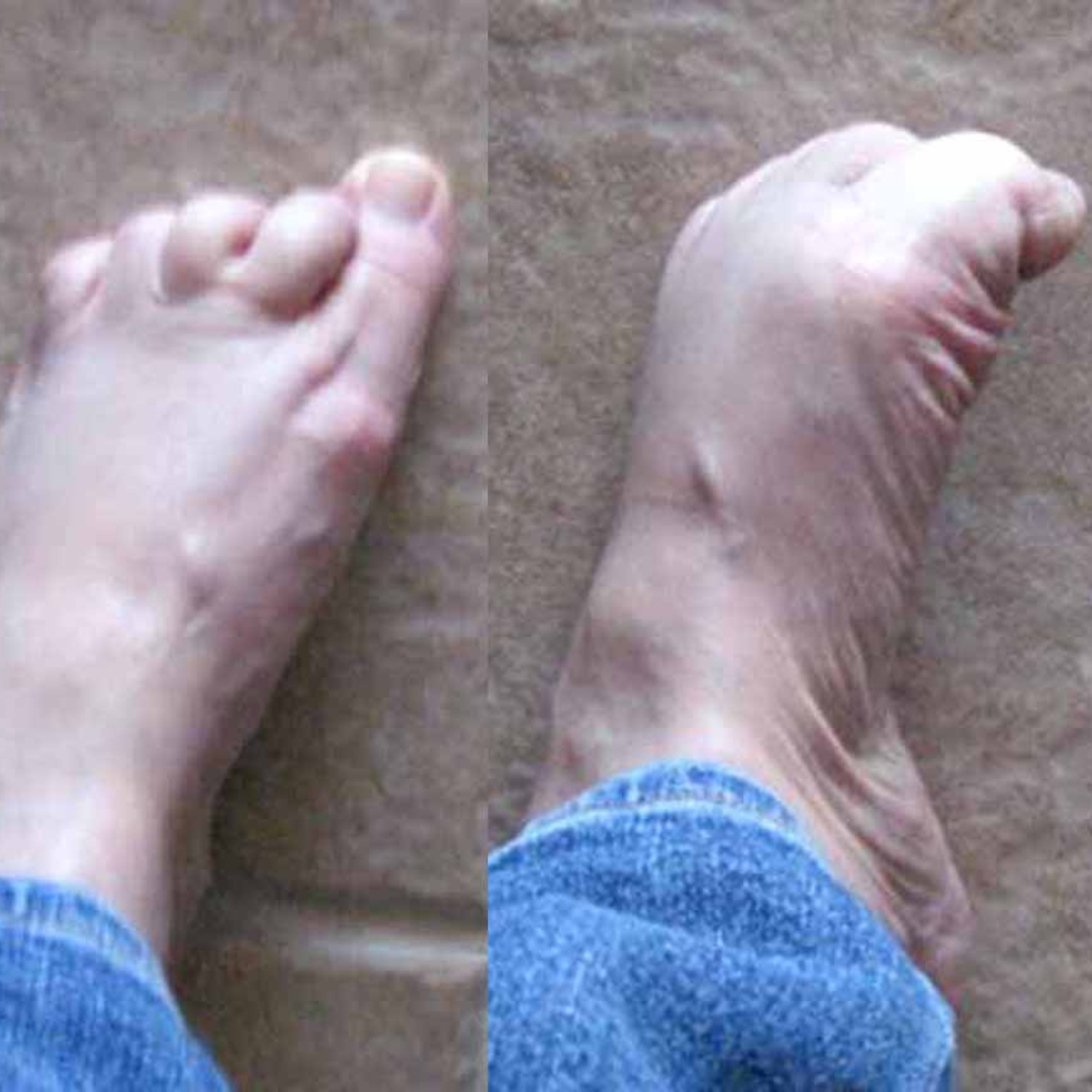 Parkinson Recovery Community Facebook ad