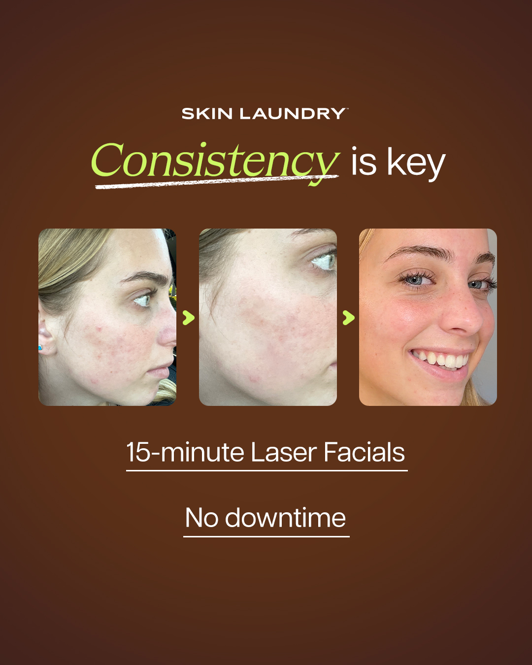 Skin Laundry Facebook ad