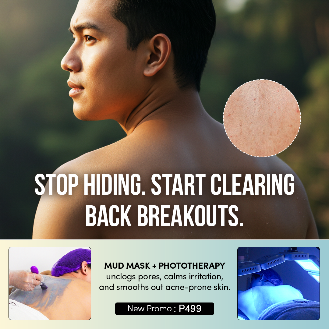 Emanuelle Beauty Facebook ad: P499 Only! | Bye Bye Back Acne