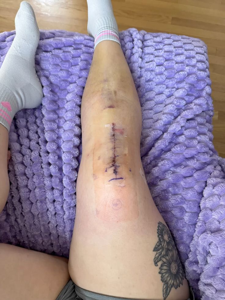 Emma Leben Facebook ad: Der wahre Grund warum du chronische Knieschmerzen hast
