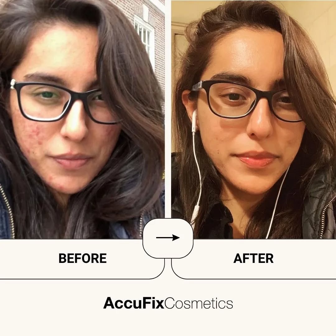 AccuFix Cosmetics Facebook ad