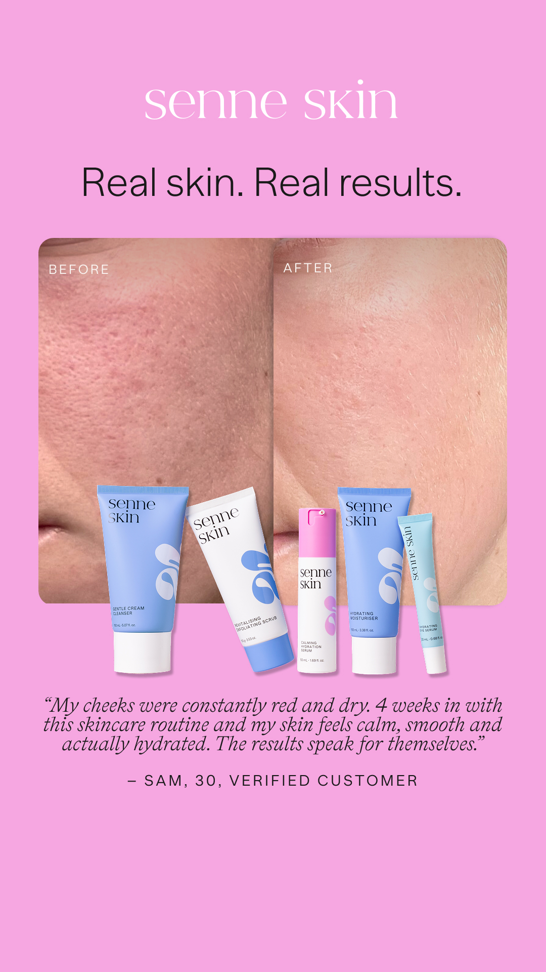 Senne Skin Facebook ad from Feb 3, 2026