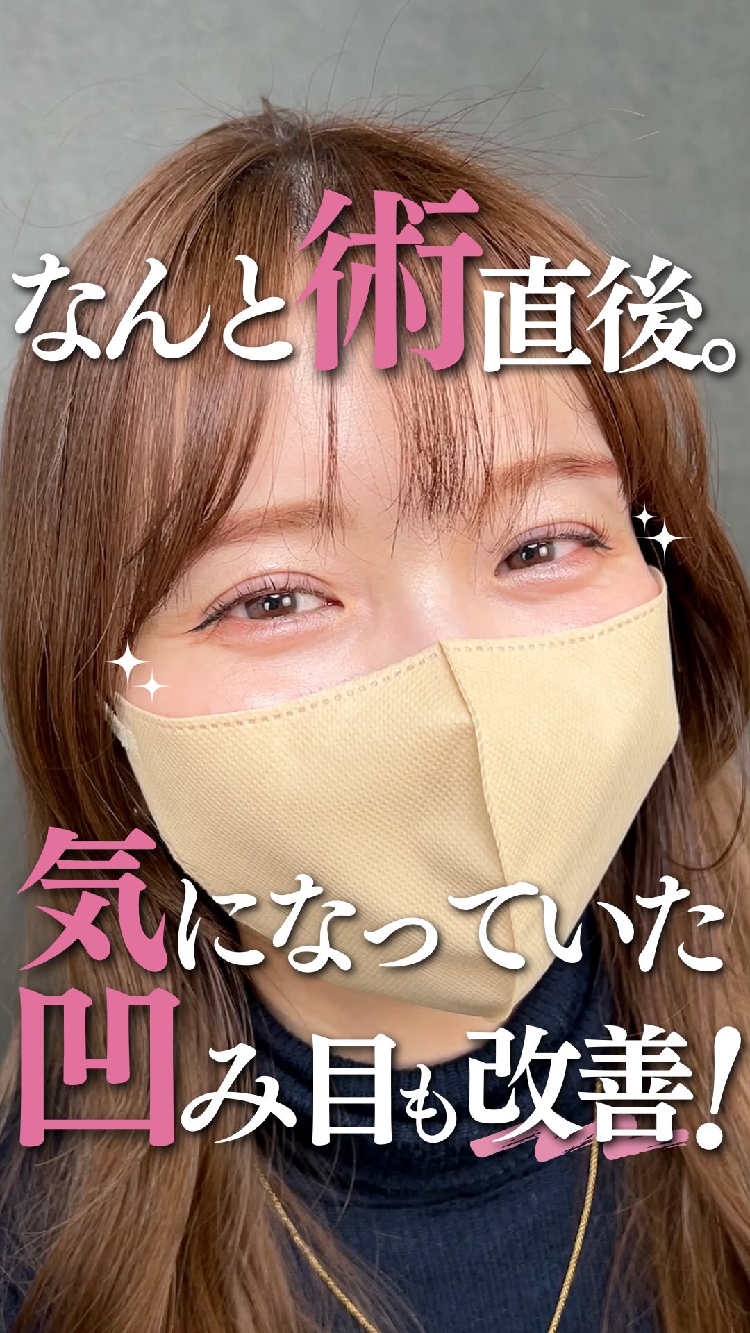 二重整形専門 酒井知子 Facebook ad: 元々二重でしたが、