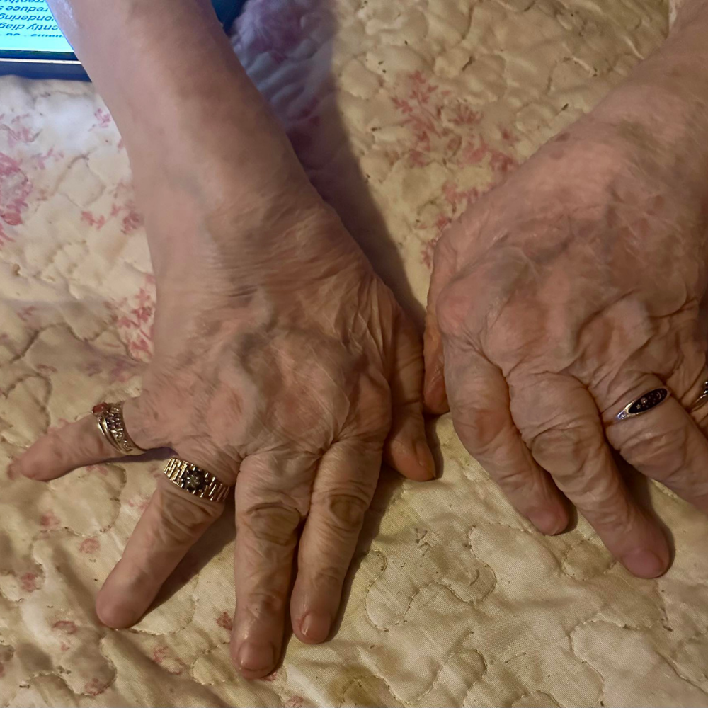 The Menopause Journal Facebook ad: Menopause did this to her hands