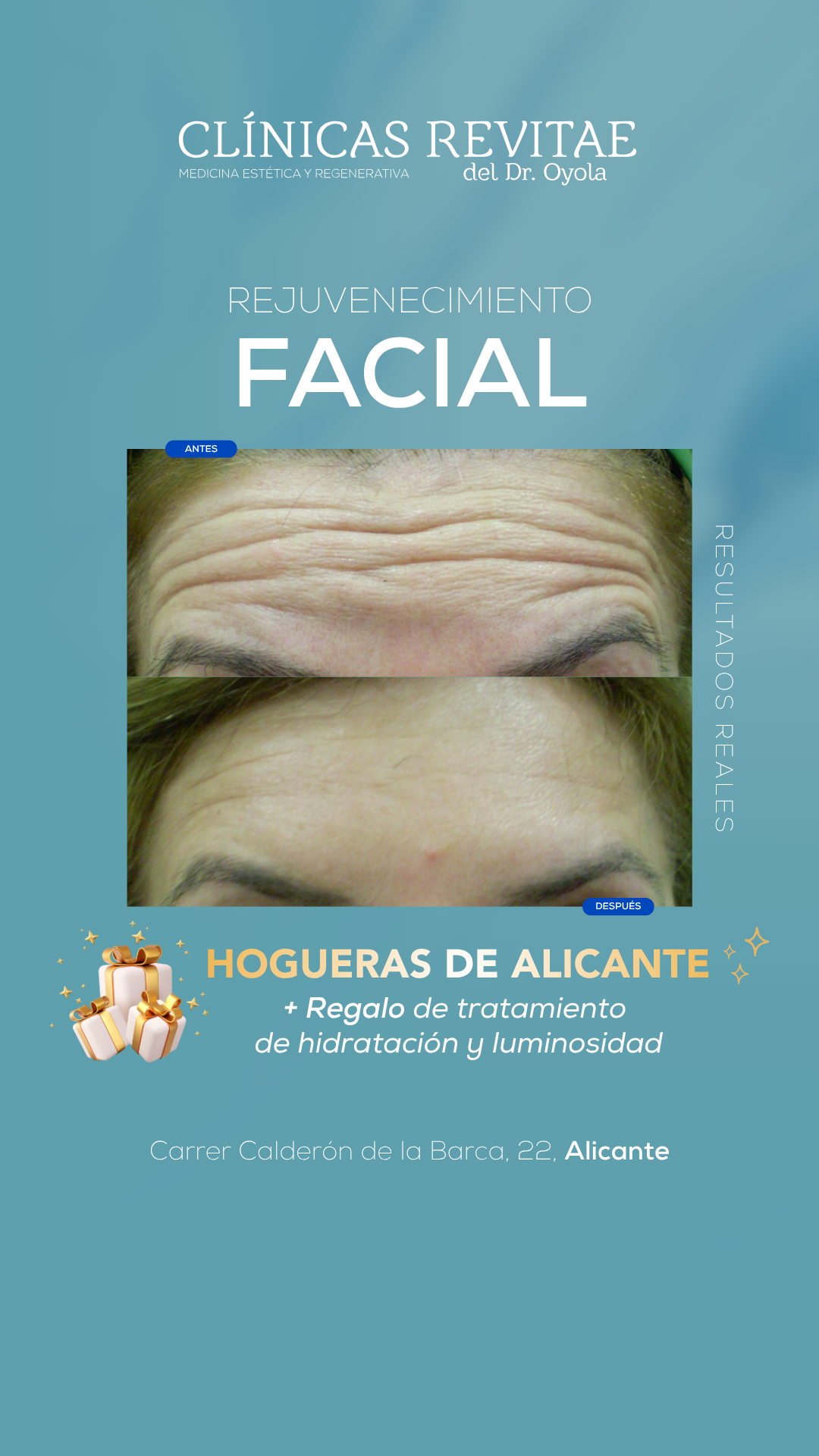 Clínicas Revitae Facebook ad