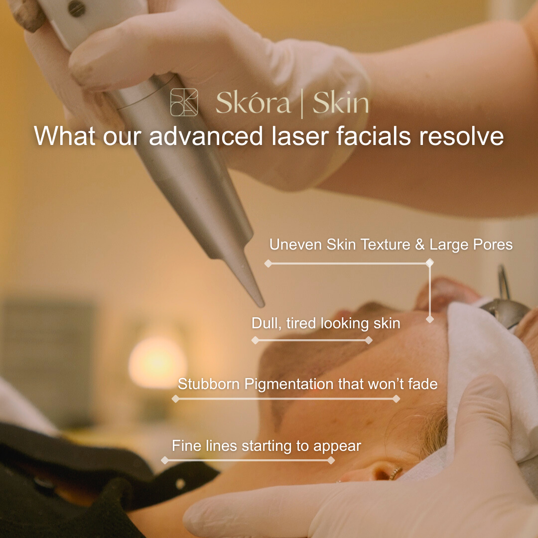 Skóra.au Facebook ad: Struggling with Pigmentation, Melasma, Sunspots & Uneven…