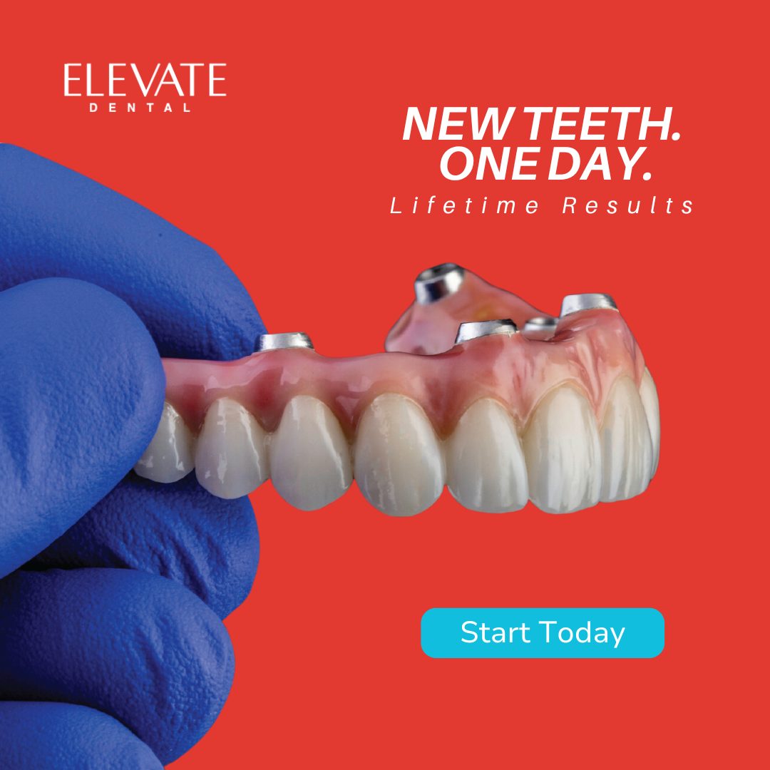 Elevate Dental Dayton Facebook ad: Discover Immediately