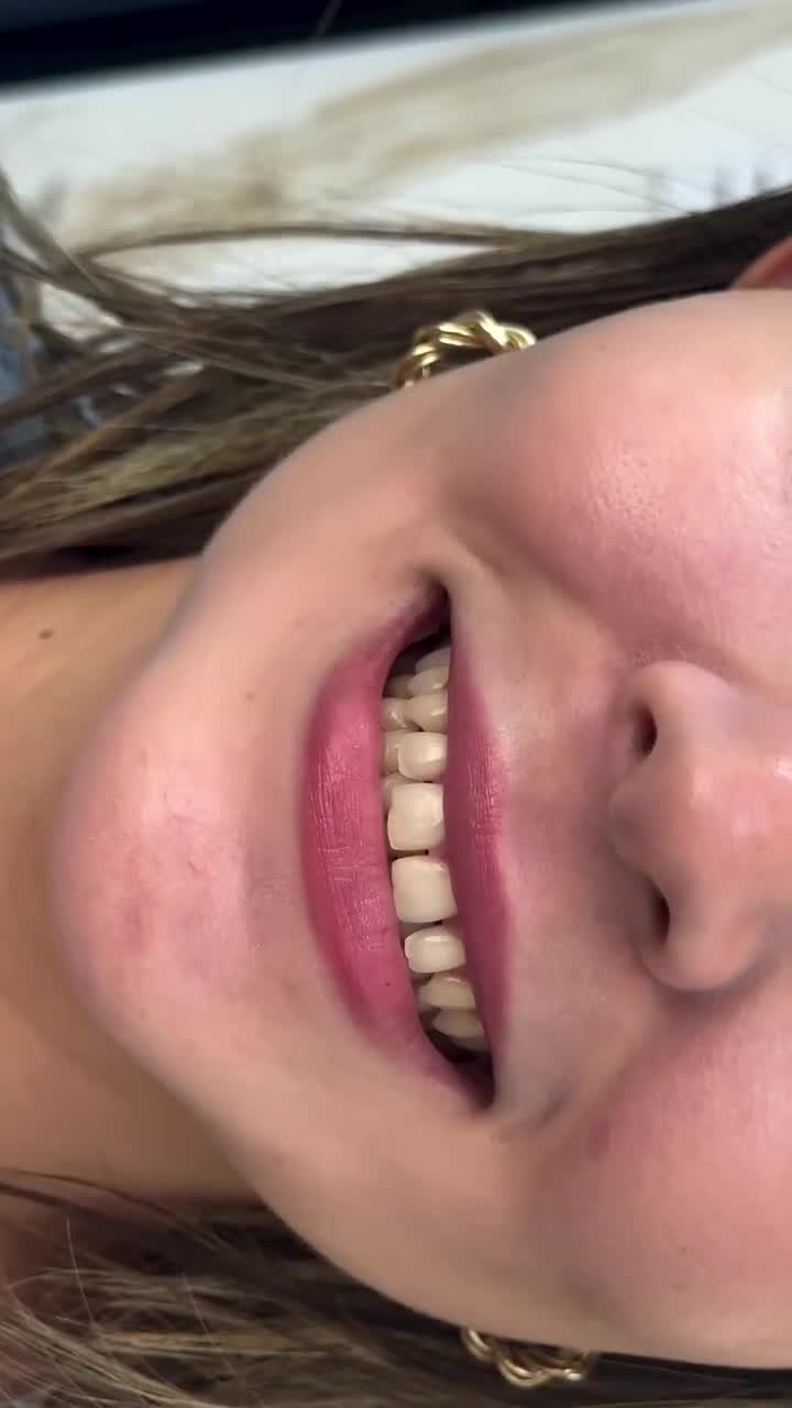 Dr Marcelo Carvalho Facebook ad: Seu novo sorriso começa aqui, em São Paulo.