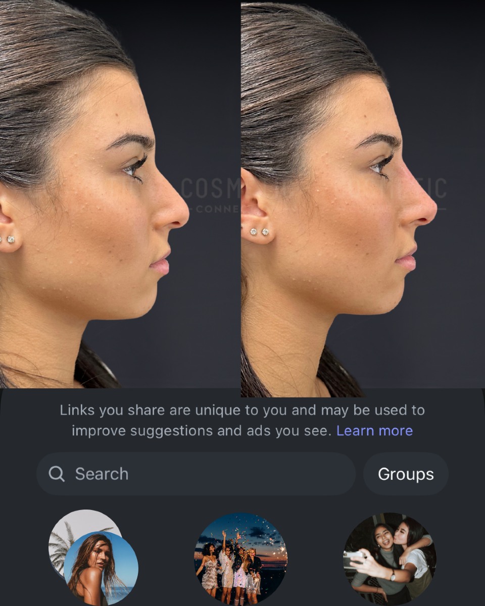 Dr Aaron Stanes - Anti Ageing & Cosmetic Doctor Facebook ad: Our most shared post is too good to…