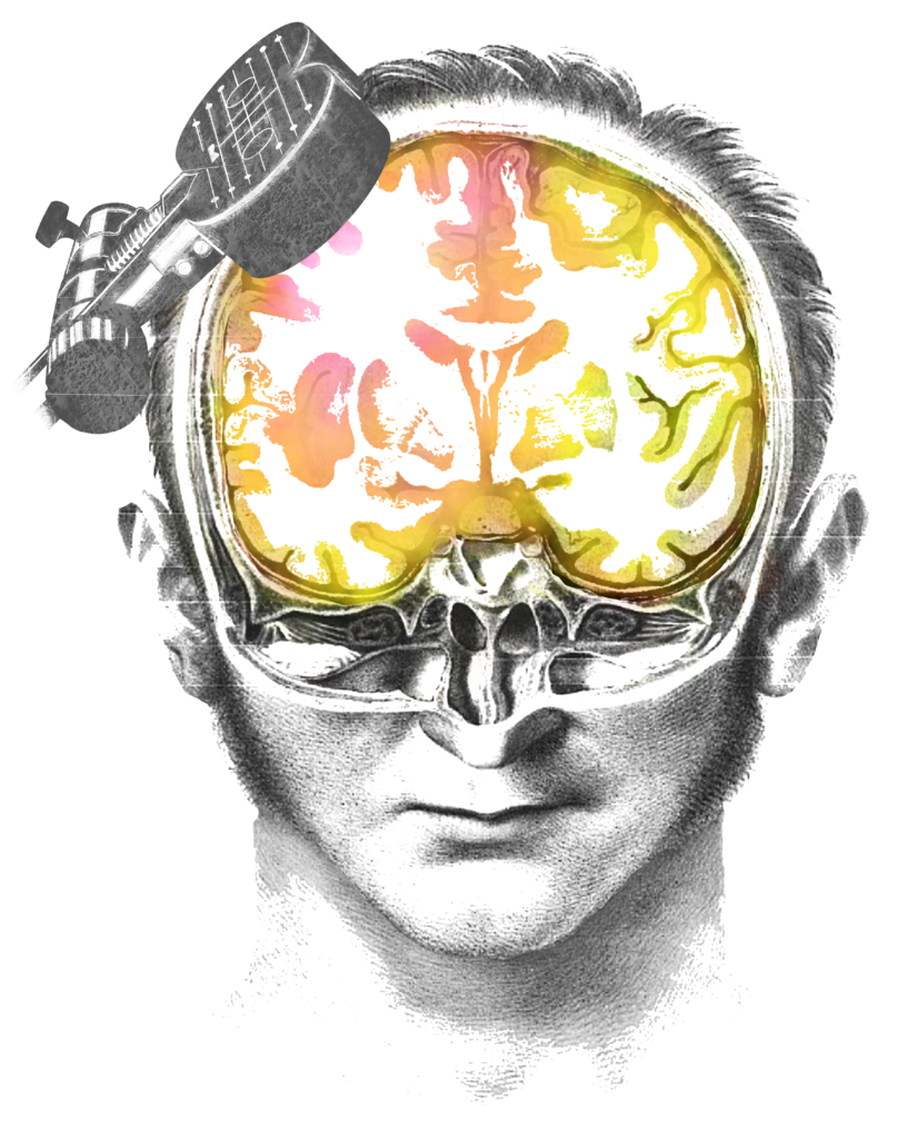 Bloom rTMS Facebook ad: rTMS Therapy in Calgary