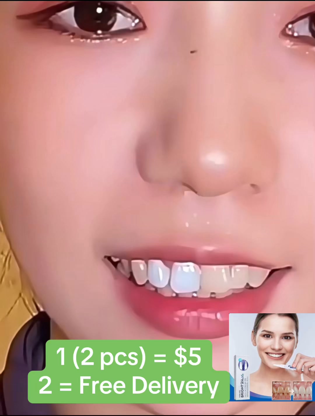 HH Shop Phnom Penh Facebook ad: ប៊ិច​ធ្វើ​ឲ្យ​ធ្មេញ​ស (Teeth Whitening Pen)